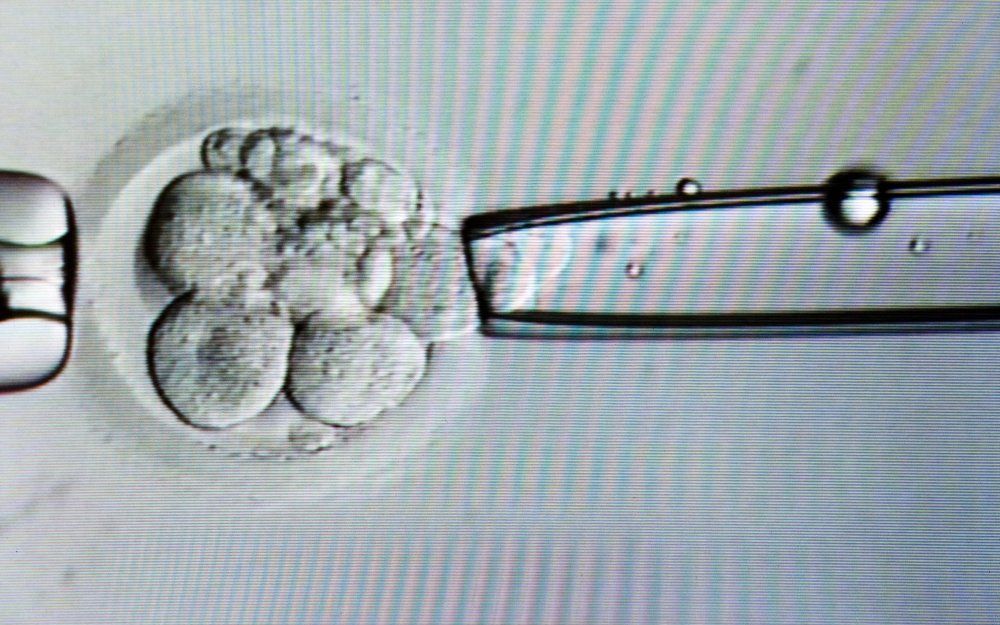 Biopsie van een cel uit een achtcellig embryo op de IVF-afdeling van het academisch ziekenhuis Maastricht (azM).  Foto ANP