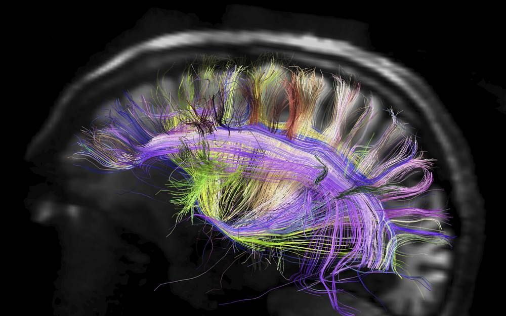 De zenuwbekabeling in de linker hersenhelft. Foto Science, Van Wedeen