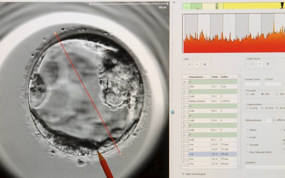 „Ook een embryo is een uniek schepsel met door God gegeven leven. Dat leven mag niet worden gebruikt, of liever gezegd misbruikt”  Foto EPA