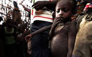Miljoenen mensen lijden honger als gevolg van de ergste droogte in decennia in de Hoorn van Afrika. Foto EPA