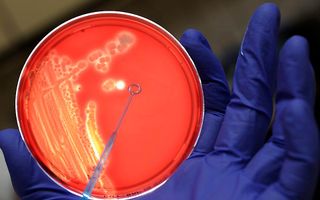EHEC-bacterie. Foto EPA
