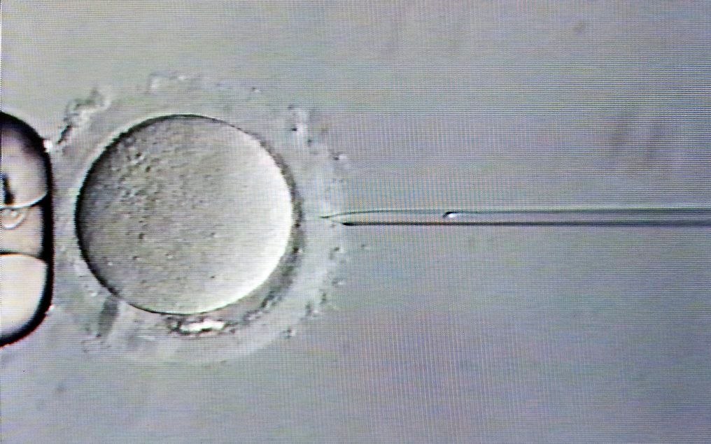 Injectie van een zaadcel in een eicel bij een ivf-procedure. Wetenschappers hanteerden in de VS een schaar waarbij een fout gen met succes werd verwijderd. beeld ANP, Lex van Lieshout