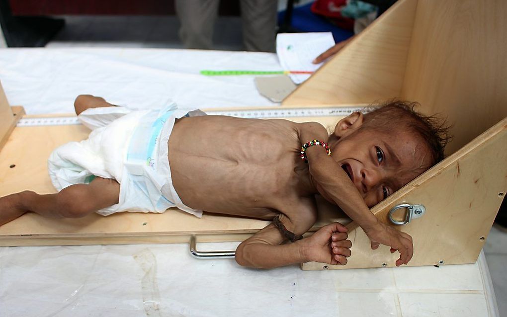 Het is hoog tijd dat de internationale gemeenschap de honger in Jemen serieus aanpakt. beeld AFP, Essa Ahmed