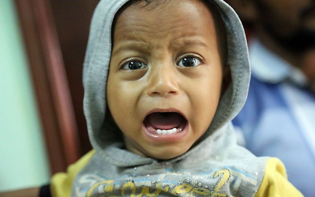 Dit meisje uit Jemen lijdt vermoedelijk aan cholera. beeld AFP