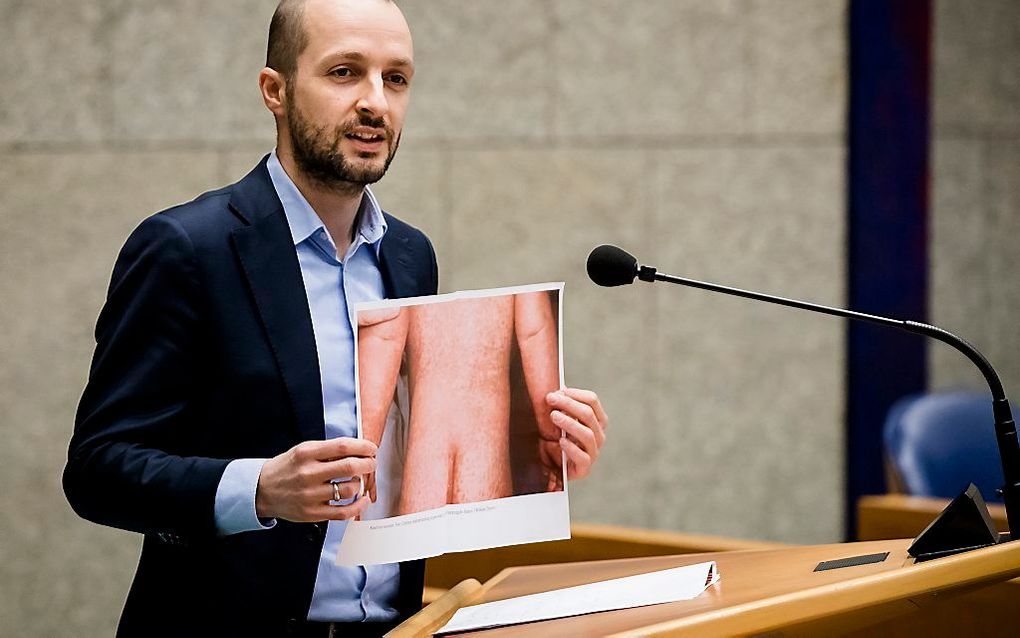 Maarten Heijink (SP) laat een foto zien van iemand met de mazelen tijdens een Tweede Kamerdebat over vaccinatie. beeld ANP