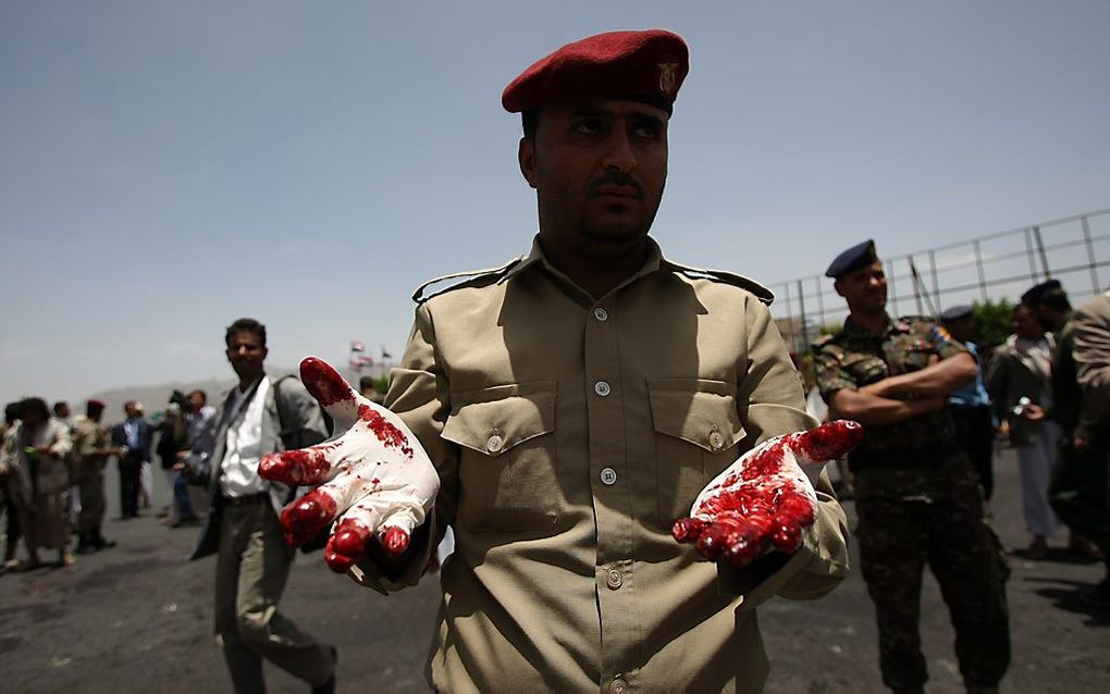 Een zelfmoordaanslag in Sanaa heeft zeker 96 mensen het leven gekost.  Foto EPA