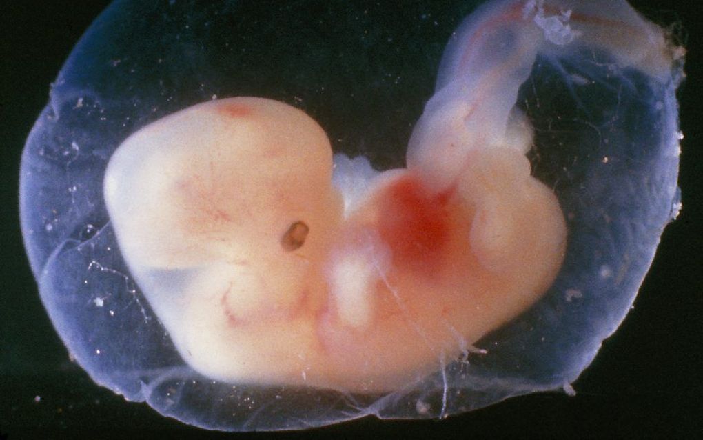 Een embryo van 5 tot 6 weken. Foto VBOK