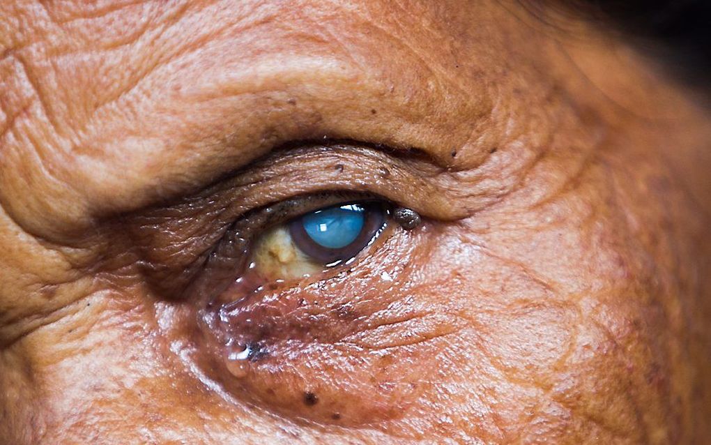 Ram Maya wacht op een oogbehandeling bij een kliniek die gratis zorg levert. Foto EPA