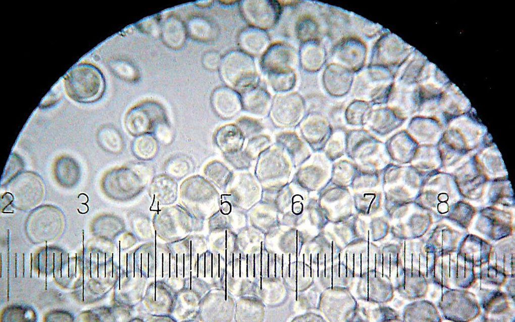 Amerikaanse wetenschappers hebben een kunstmatig chromosoom gebouwd. Ze gebruikten daarvoor speciale software en 272.000 chemische bouwstenen. Het chromosoom plaatsten ze vervolgens in levende gistcellen. Die bleken vervolgens goed te functioneren. Beeld 