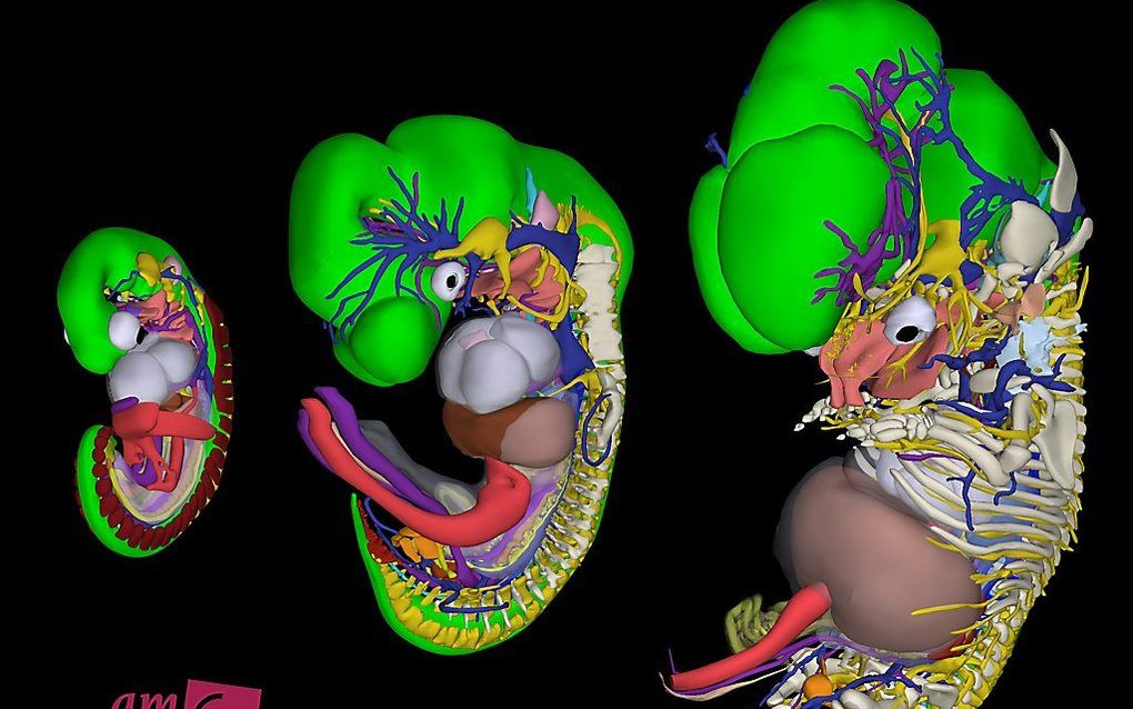 3D-reconstructie van een menselijk embryo, van links naar rechts na 6, 8 en 9,5 weken zwangerschap.  beeld Bernadette de Bakker, MD of the Academic Medical Center in Amsterdam, The Netherlands