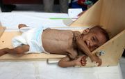 Het is hoog tijd dat de internationale gemeenschap de honger in Jemen serieus aanpakt. beeld AFP, Essa Ahmed