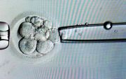Biopsie van een cel uit een achtcellig embryo op de IVF-afdeling van het academisch ziekenhuis Maastricht (azM). beeld ANP