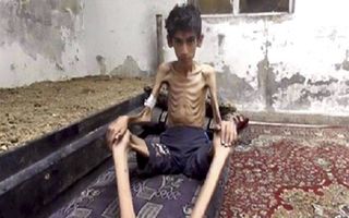 Honger in Syrië. beeld AP