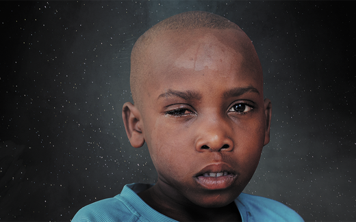 De 7-jarige Elissa uit Rwanda heeft met spoed een oogoperatie nodig. 