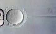 De injectie van een zaadcel (links, zichtbaar in de naald) in een eicel als onderdeel van de IVF-procedure. beeld ANP