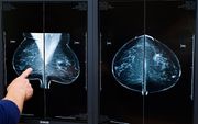 Een radioloog bekijkt röntgenfoto’s bij een bevolkingsonderzoek naar borstkanker. beeld ANP, Koen Suyk