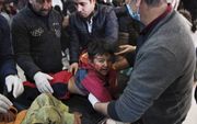 Een kind, verwond door een Turkse luchtaanval op een dorp in Afrin, wordt behandeld in een ziekenhuis. beeld AFP, George Ourfalian