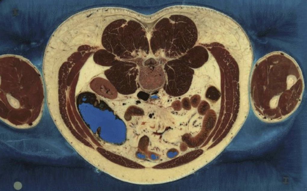 Luguber project: digitale anatomische atlas van de mens