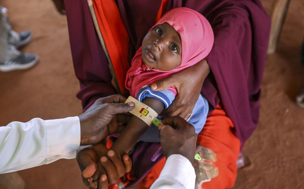 Een baby uit Somalië wordt behandeld door een arts. beeld EPA, Daniel Irungu