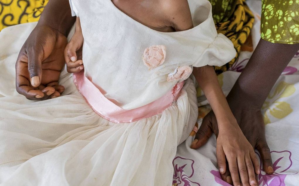 Een jong meisje wacht op behandeling in een kliniek in Lipemba, in de Congolese regio Kasai. Ondervoeding is in de regio een groot probleem. beeld AFP, Arsene Mpiana