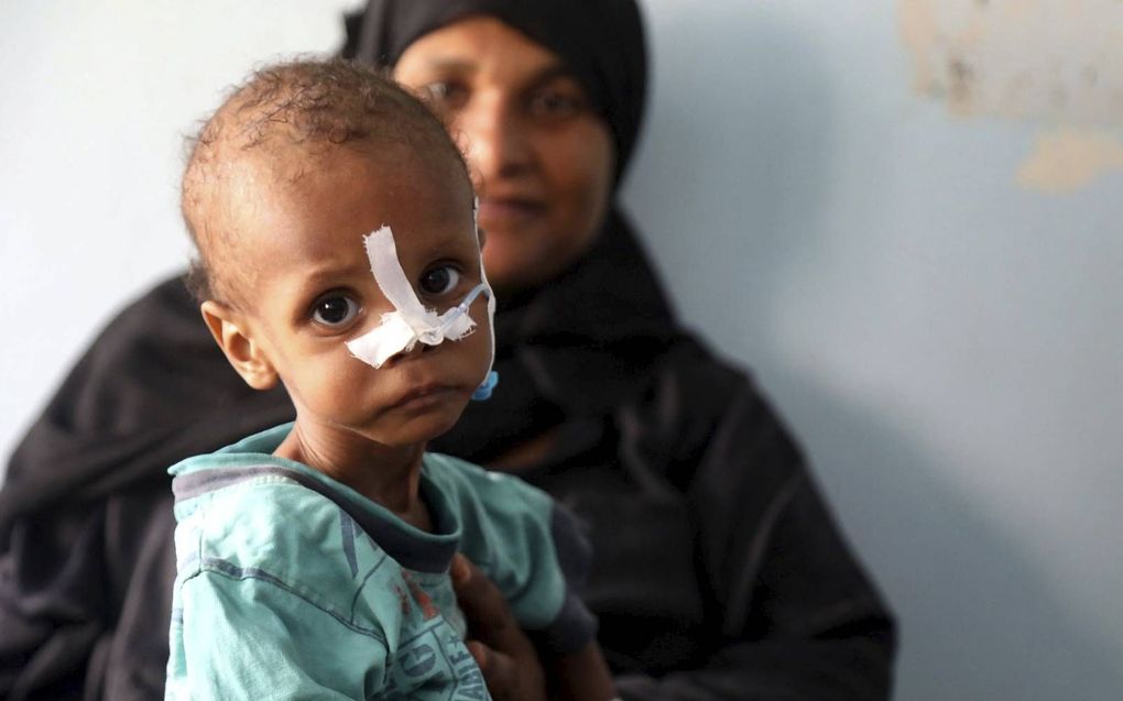 Een moeder bezoekt met haar ondervoede kind een kliniek in de Jemenitische stad Taez, 3 juli. Conflicten zijn nog altijd de belangrijkste oorzaak van honger. In Jemen woedt al jarenlange een burgeroorlog. beeld AFP, Ahmad al-Basha