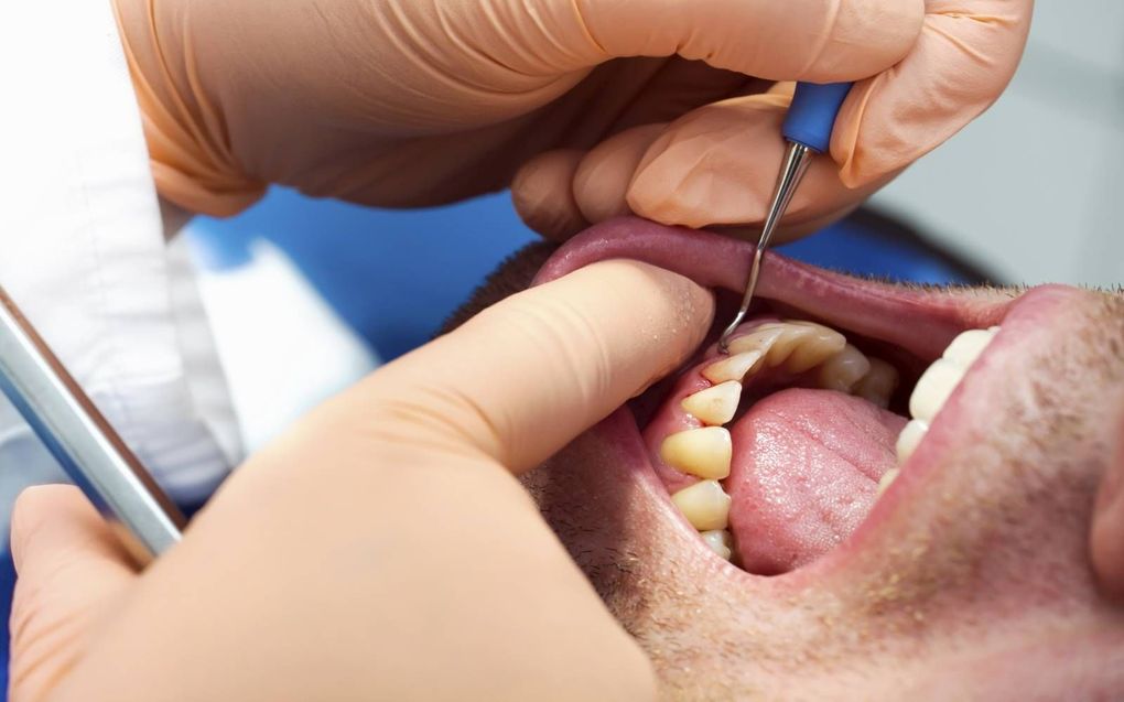 Volgens nieuw Brits onderzoek staat een slechte mondhygiëne in verband met een hoger risico op allerlei chronische ziektes, maar ook op mentale gezondheidsproblemen zoals angst en depressie. beeld Getty Images