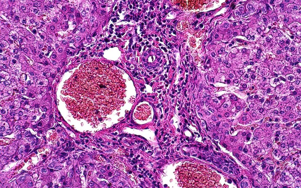 Kankercellen. beeld iStock
