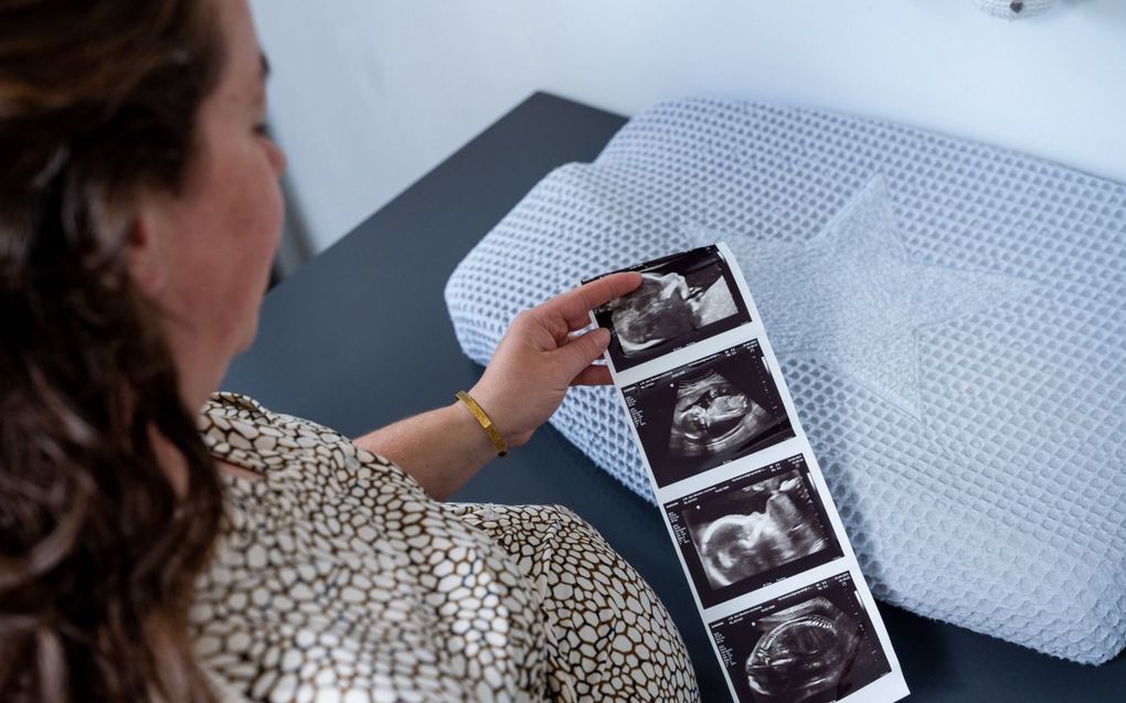 Sinds september kunnen vrouwen kiezen voor een 13 wekenecho. beeld NPV, Cees van der Wal