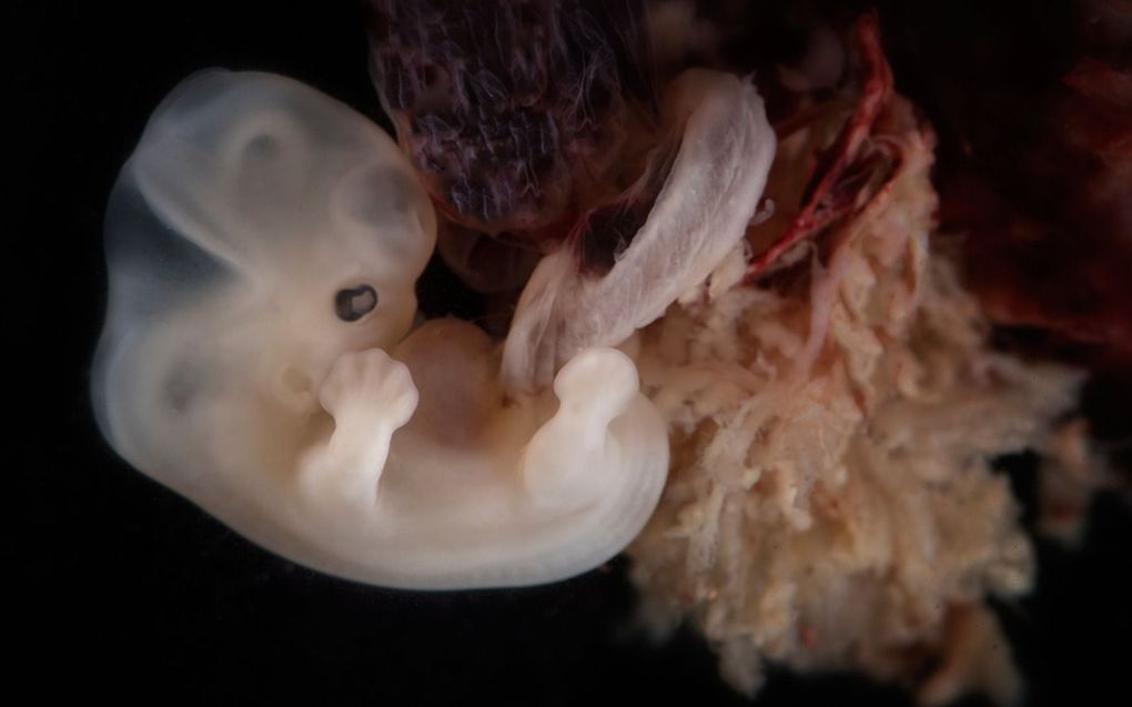 Embryo van zo’n zes weken oud. beeld Wikimedia, Lunar Caustic