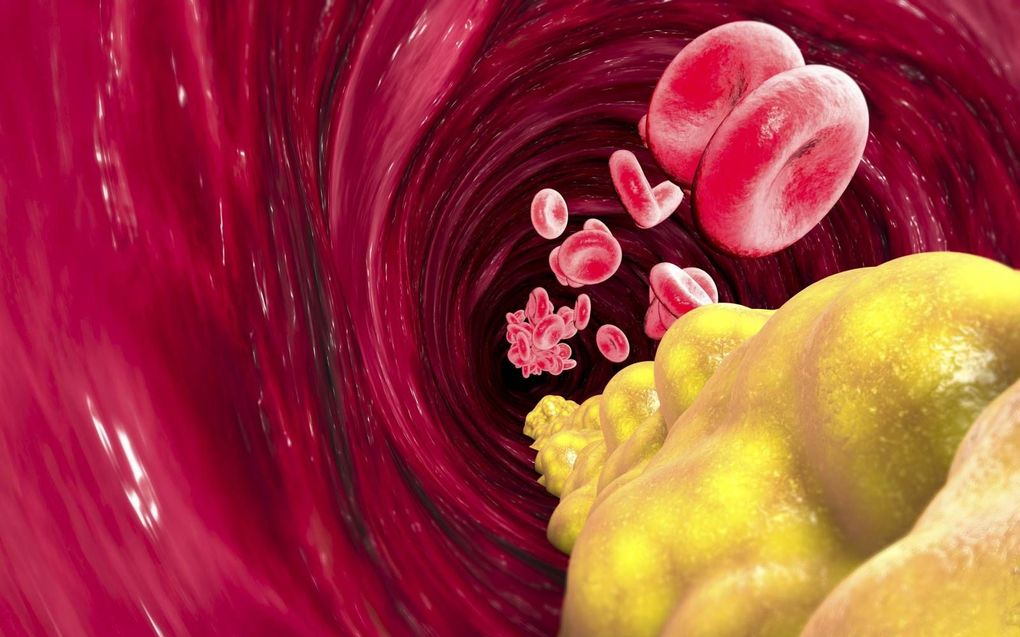 Cholesterol is een onmisbare bouwsteen voor ons lichaam. Niemand weet wat langdurig gebruik van het sterk cholesterolverlagende Repatha op de lange duur te weeg zal brengen. beeld iStock