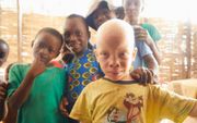 Zolang er in Afrikaanse dorpen geen ziektes uitbreken, of iemand plotseling overlijdt, zijn albino's veilig. Bij onraad worden ze al gauw gezien als de veroorzakers ervan.  beeld Jaco Klamer