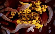Dit is een microscopische foto van het coronavirus (geel) die te voorschijn komt uit het oppervlak van menselijke cellen (roze). beeld EPA