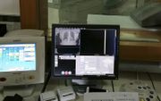 De zogeheten CT-scanner maakt gebruik van röntgenstraling om in het menselijk lichaam te kijken. Op de foto wordt een patiënt doorgelicht.  beeld Wikimedia, Ptrump