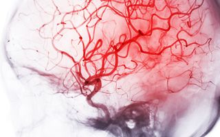 Bloedvaten in het brein. beeld iStock