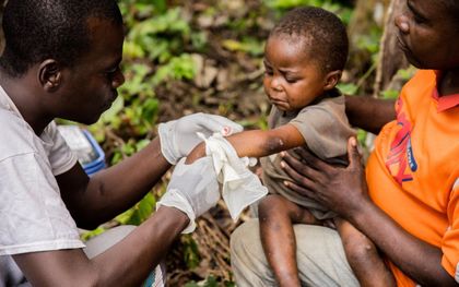 Een kind met het apenpokkenvirus wordt behandeld in de Centraal-Afrikaanse Republiek. beeld AFP, Charles Bouessel