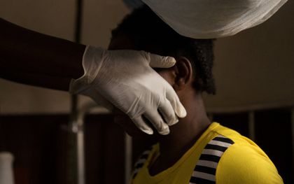 Een patient met het apenpokkenvirus. beeld AFP, CHARLES BOUESSEL