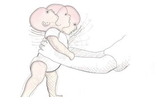 Een tekening van een kindje dat wordt vastgehouden aan de romp. Het hoofdje schudt heen en weer.