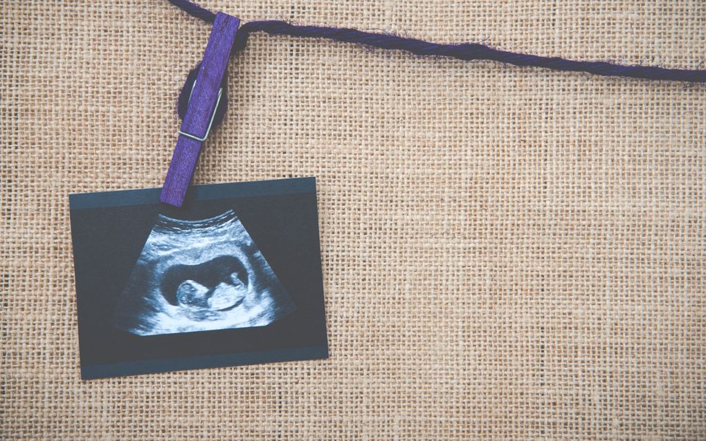 „Een groot onderzoek onder 5500 wetenschappers uit Amerika geeft aan dat 95 procent van hen het begin van het leven ziet bij de bevruchting.” beeld iStock