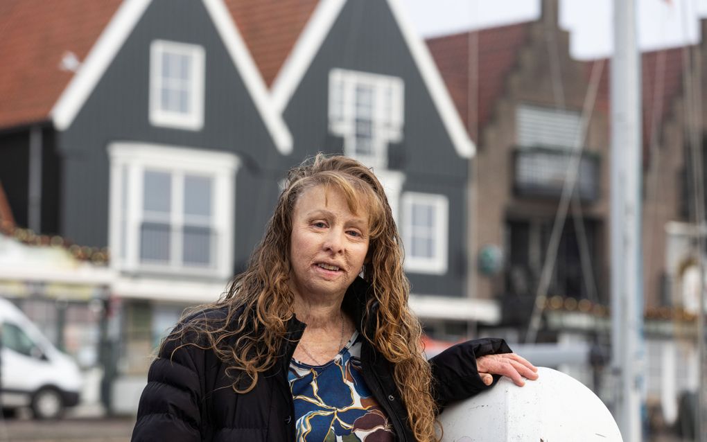 Monique Tuijp overleefde cafébrand Volendam: „Ik kreeg een golf van vuur over me heen”
