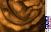 Een actieve foetus van 12 weken oud in de baarmoeder. De foetus probeert stapjes te maken op dezelfde manier als een pasgeboren baby van wie de voetjes een plat oppervlak raken. Foto prof. Campbell