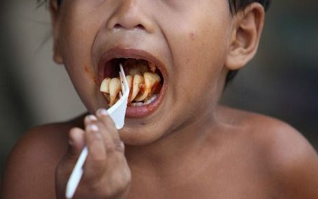 Het aantal mensen dat acute honger lijdt is hoger dan ooit. Foto EPA