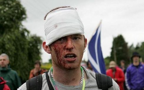 GLENEAGLES - Een betoger zit onder het bloed, nadat hij in aanraking is gekomen met een politiestok. De honderden agenten met honden hebben soms de grootste moeite om de demonstranten in het gareel te houden. Foto EPA