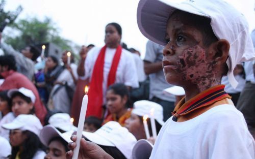 DHAKA â€“ Een Bengaalse jongen loopt met een brandende kaars mee in een protestdemonstratie tegen aanvallen met bijtend zuur. Mannen die zijn afgewezen door vrouwen, gooien bijtend zuur in het gezicht van de vrouwen waardoor die hun leven lang verminkt zi