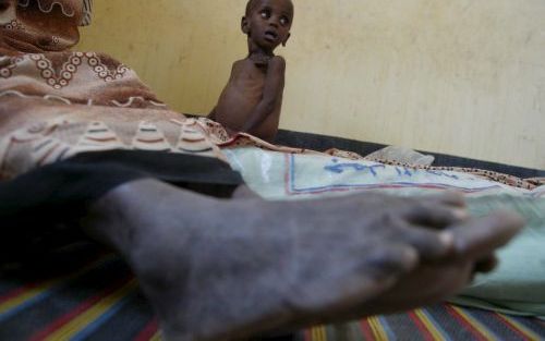 EL WAK â€“ Een ondervoed kind wacht met zijn moeder op voedsel in een kliniek van Artsen zonder Grenzen in Kenia. Grote delen van Oost Afrika kampen met hongersnood als gevolg van aanhoudende droogte. Foto EPA