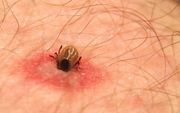 Een besmette teek kan de ziekte van Lyme veroorzaken. beeld Wikimedia