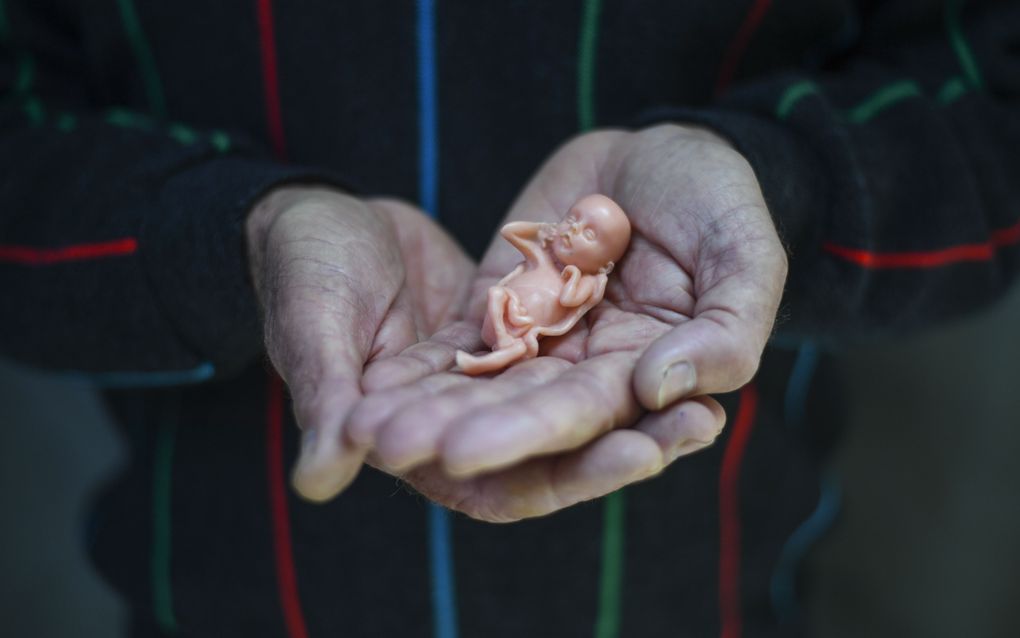 Een anti-abortusdemonstrant houdt een model van een twaalf weken oude foetus vast. beeld EPA, Lukas Coch