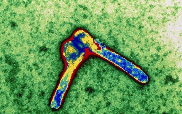 LEIDEN - Microscopische afbeelding van het marburgvirus. De Nederlandse vrouw die in Uganda een besmetting met het marburgvirus opliep, is vrijdag in het Leids Universitair Medisch Centrum (LUMC) overleden. Foto ANP