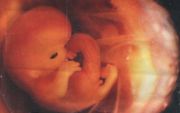 „Laten we ons verwonderen over de ontwikkeling van het ongeboren leven in de moederschoot.” Foto VBOK