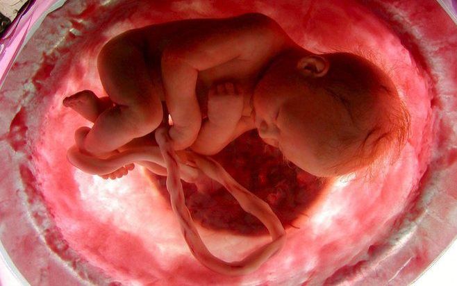 „Wie zwangerschapsafbreking afwijst, kan in de huidige opzet beter geen twintigwekenecho laten maken.” Foto EPA