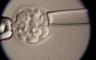 DEN HAAG – Het kabinet heeft vrijdag de knoop doorgehakt over de selectie van embryo’s. Het Academisch Ziekenhuis Maastricht (AZM) mag op meer ziektes gaan selecteren dan nu de praktijk is. Foto ANP